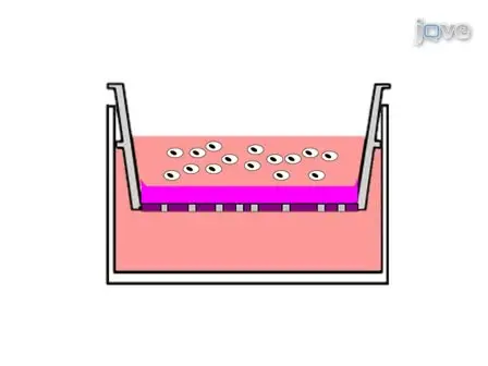 An <em>In vitro</em> FluoroBlok Tumor Invasion Assay