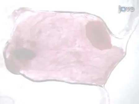 Mammary Epithelial Transplant Procedure