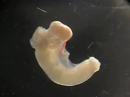 Retrieval of Mouse Oocytes