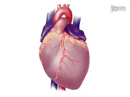 Acute Myocardial Infarction in Rats