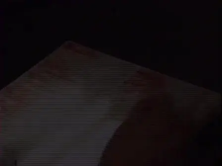Rat Mesentery Angiogenesis Assay