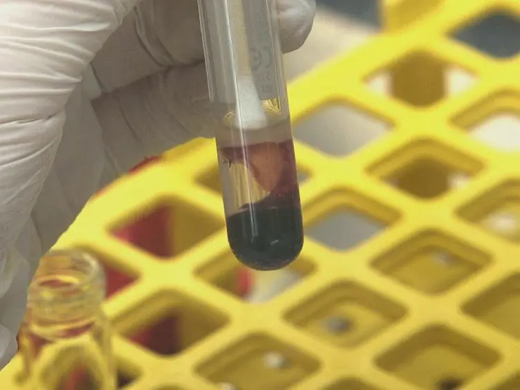One-day Workflow Scheme for Bacterial Pathogen Detection and Antimicrobial Resistance Testing from Blood Cultures