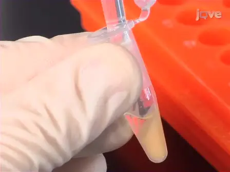 Chromatin Isolation by RNA Purification (ChIRP)