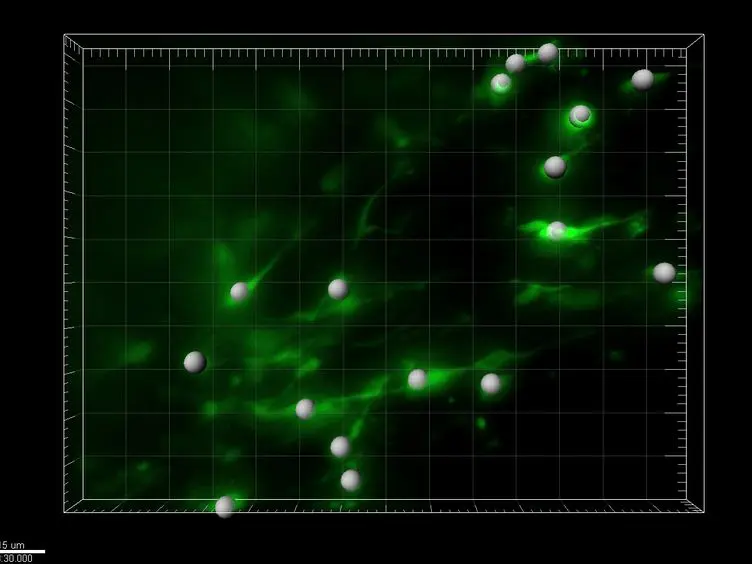 Time-lapse Imaging of Neuroblast Migration in Acute Slices of the Adult Mouse Forebrain