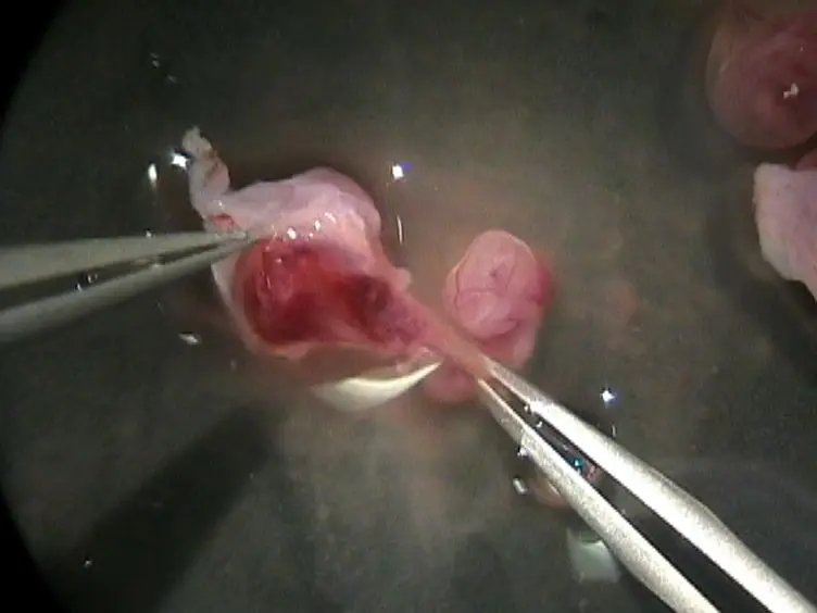 Use of LysoTracker to Detect Programmed Cell Death in Embryos and Differentiating Embryonic Stem Cells