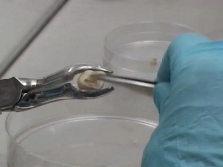 Isolation, Characterization and Comparative Differentiation of Human Dental Pulp Stem Cells Derived from Permanent Teeth by Using Two Different Methods