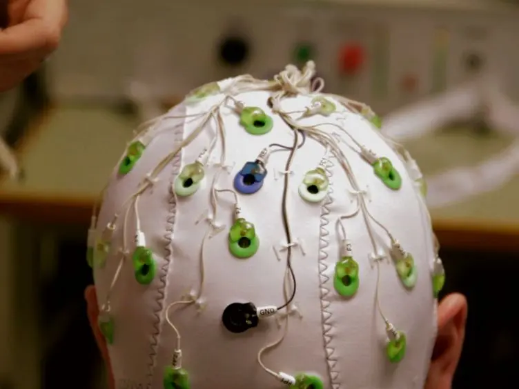 Best Current Practice for Obtaining High Quality EEG Data During Simultaneous fMRI