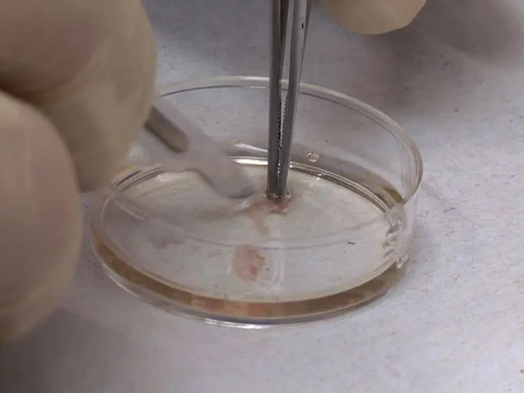 Isolation, Processing and Analysis of Murine Gingival Cells