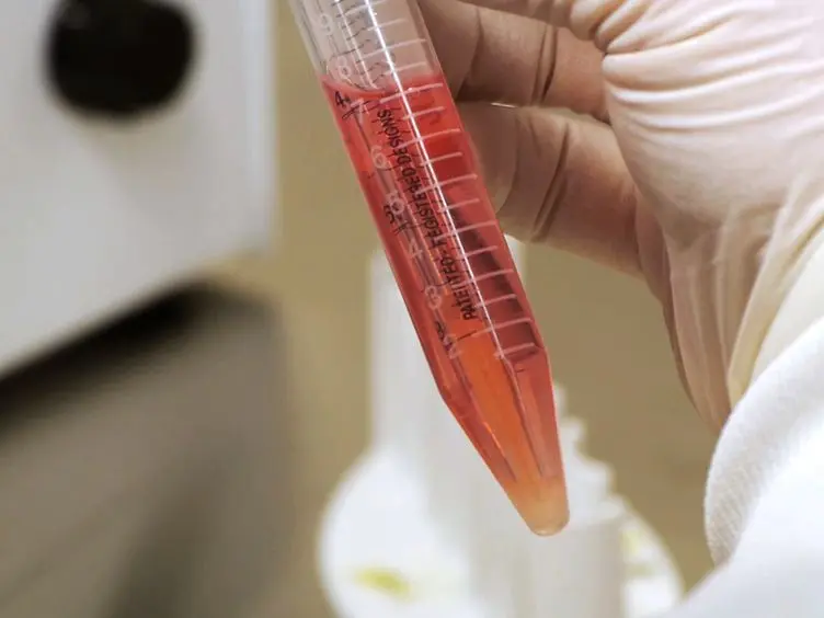 A cGMP-applicable Expansion Method for Aggregates of Human Neural Stem and Progenitor Cells Derived From Pluripotent Stem Cells or Fetal Brain Tissue