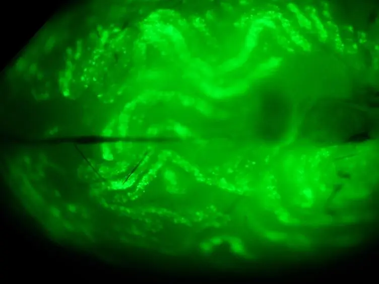 <em>In Vivo</em> Microinjection and Electroporation of Mouse Testis