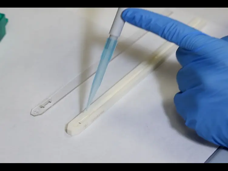 From a 2DE-Gel Spot to Protein Function: Lesson Learned From HS1 in Chronic Lymphocytic Leukemia