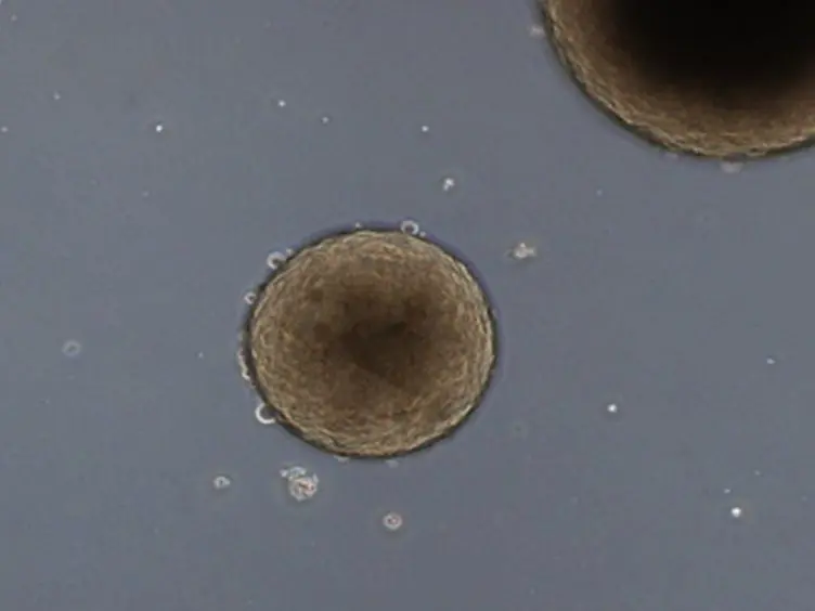 Derivation and Characterization of a Transgene-free Human Induced Pluripotent Stem Cell Line and Conversion into Defined Clinical-grade Conditions