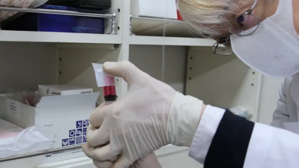 Lung Tumor Cell Recruitment Assay