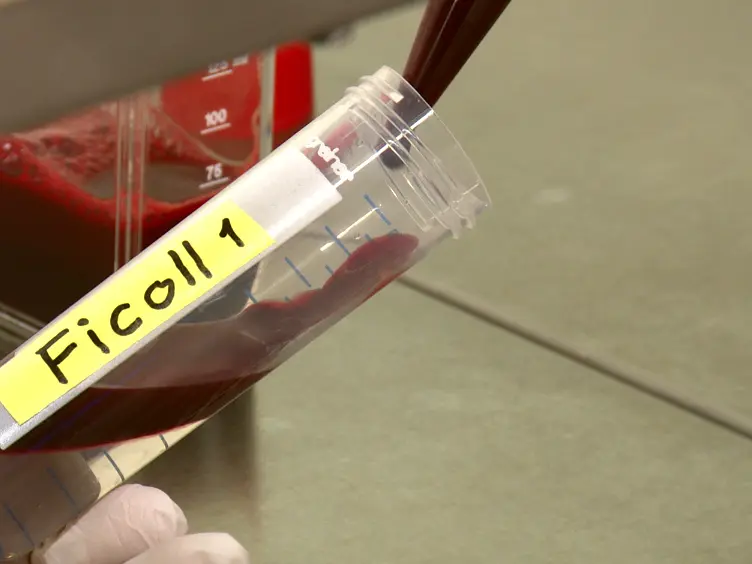 Isolation and <em>Ex Vivo</em> Culture of V&#948;1<sup>+</sup>CD4<sup>+</sup>&#947;&#948; T Cells, an Extrathymic &#945;&#946;T-cell Progenitor