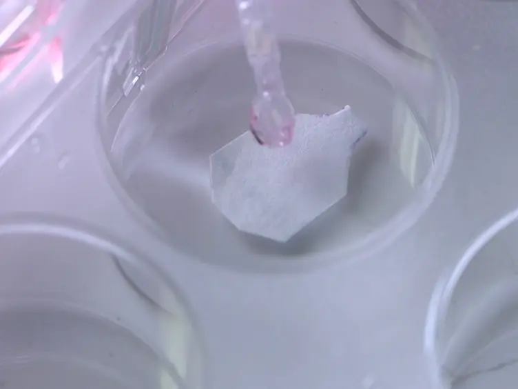 ADSC-sheet Transplantation to Prevent Stricture after Extended Esophageal Endoscopic Submucosal Dissection