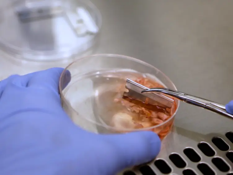 A Protocol for Rapid Post-mortem Cell Culture of Diffuse Intrinsic Pontine Glioma (DIPG)