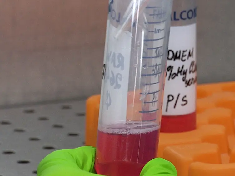 Methods for Analyzing the Impacts of Natural Uranium on <em>In Vitro</em> Osteoclastogenesis