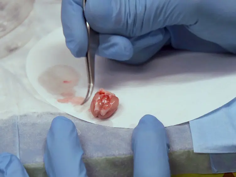 A Simple and Reproducible Method to Prepare Membrane Samples from Freshly Isolated Rat Brain Microvessels