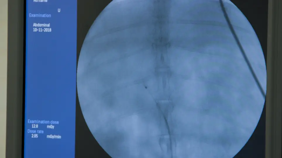 Development and Angiographic Use of the Rabbit VX2 Model for Liver Cancer