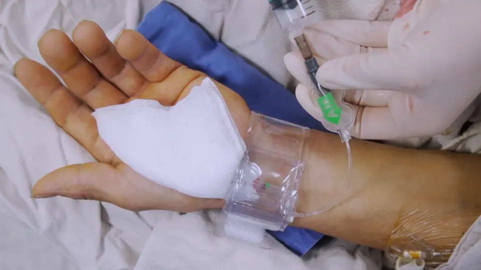 Transradial Access Chemoembolization for Hepatocellular Carcinoma Patients