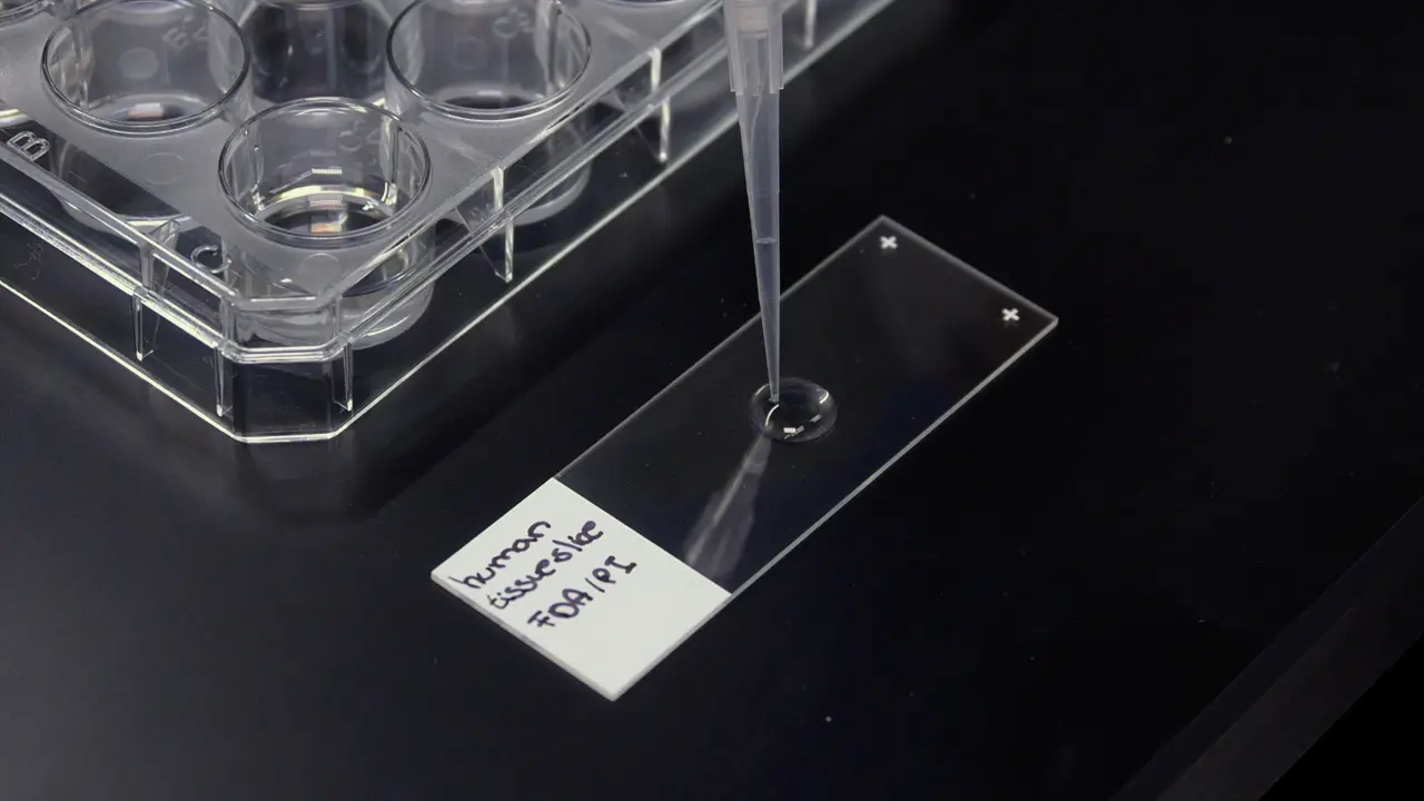 Generating Human Pancreatic Tissue Slices to Study Endocrine and Exocrine Pancreas Physiology