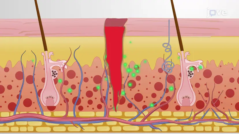 Tissue Injury: Inflammation and Repair