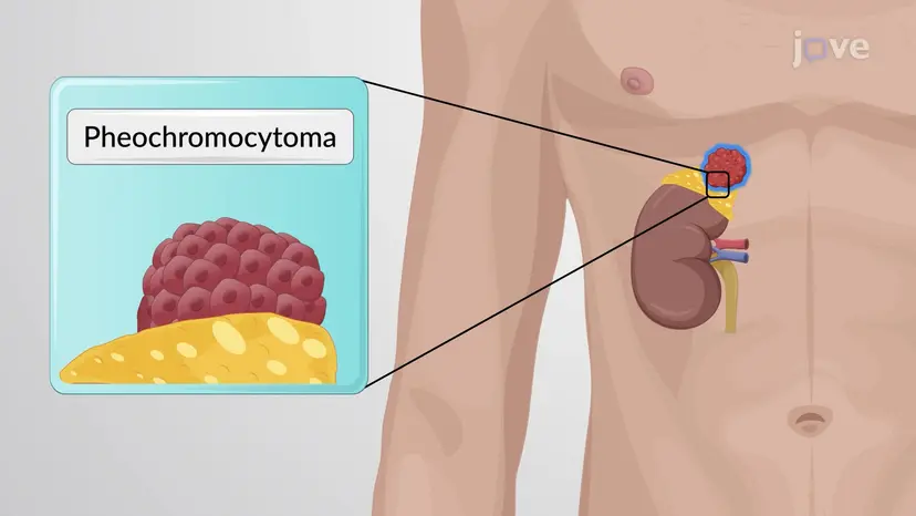 Antagoniści receptorów adrenergicznych: farmakologiczne działanie blokerów receptora ɑ