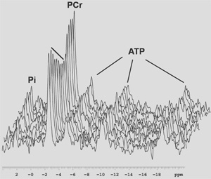 figure-protocol-17537