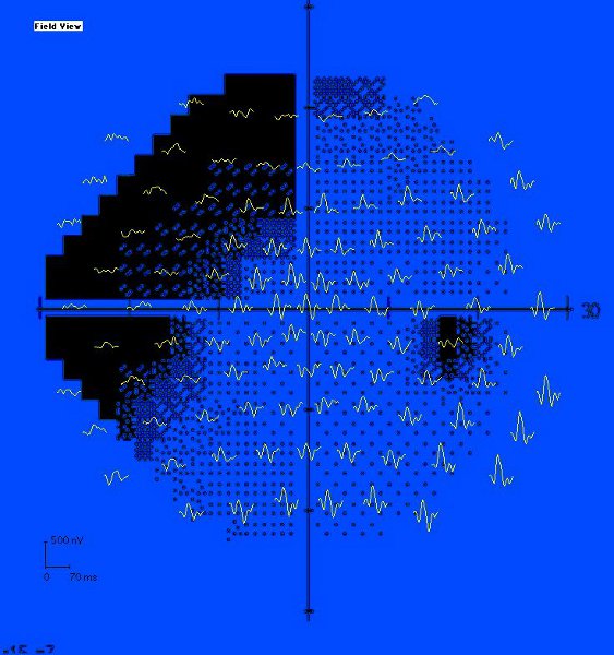 figure-protocol-3771