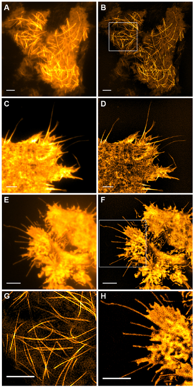 Fluorescence microscopy images of cell cytoskeleton; actin fibril network visualization.