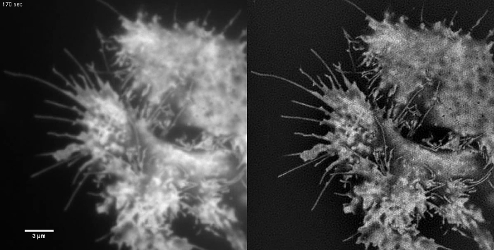 Microscopy image of cell morphology with protrusions, contrast-enhancing technique comparison.