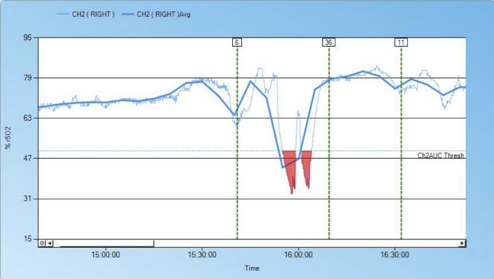 figure-results-10795