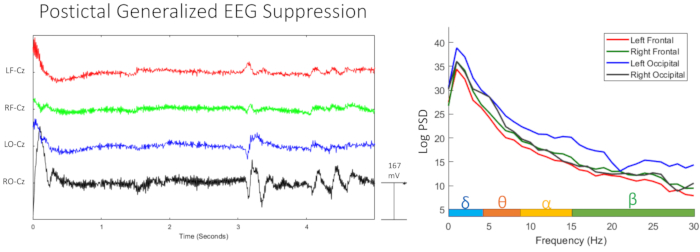 figure-results-23870