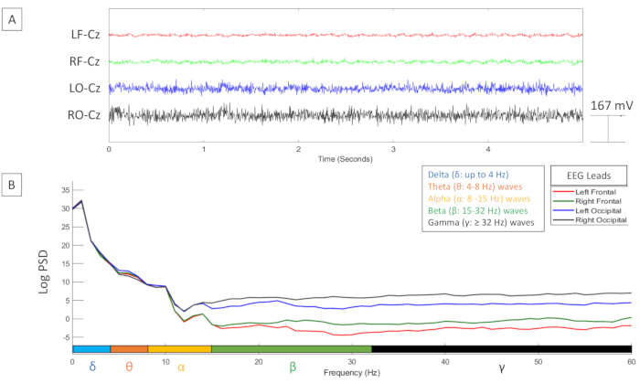 figure-results-12483