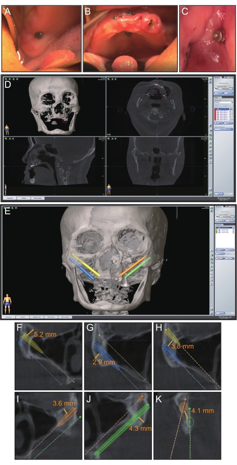 figure-results-3574