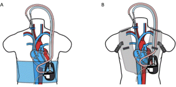 figure-results-6406