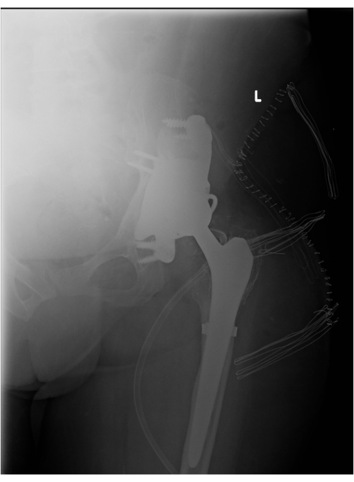 figure-results-7824