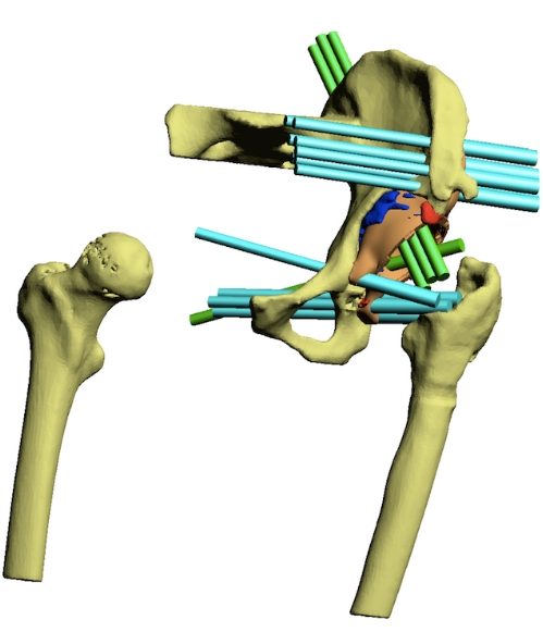 figure-results-9386
