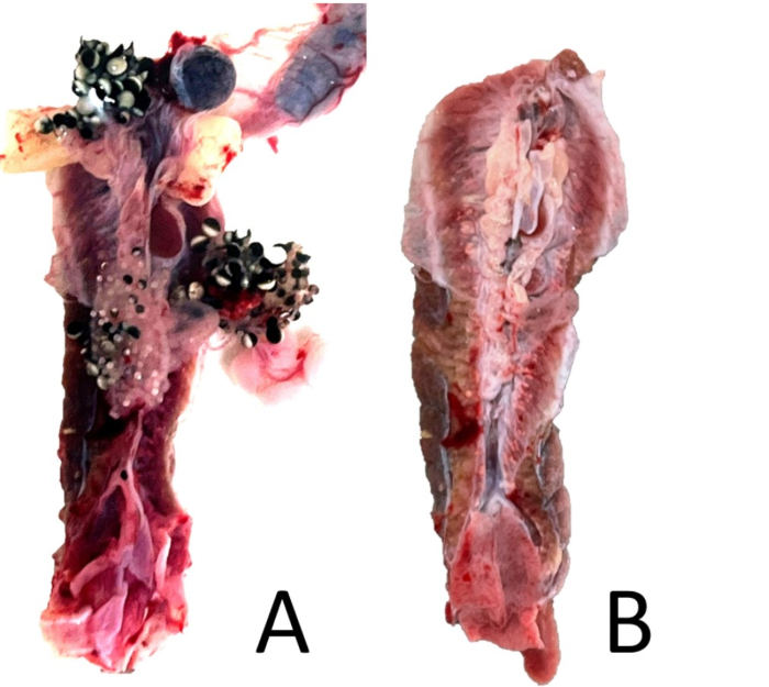 Histological comparison, diagram, sample A shows tumor samples; B shows normal tissue, pathology study.