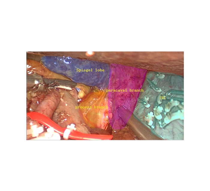 figure-results-3902
